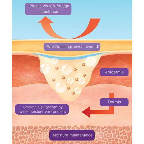 Ora-Aid conceptual intaoral wound dressing strip